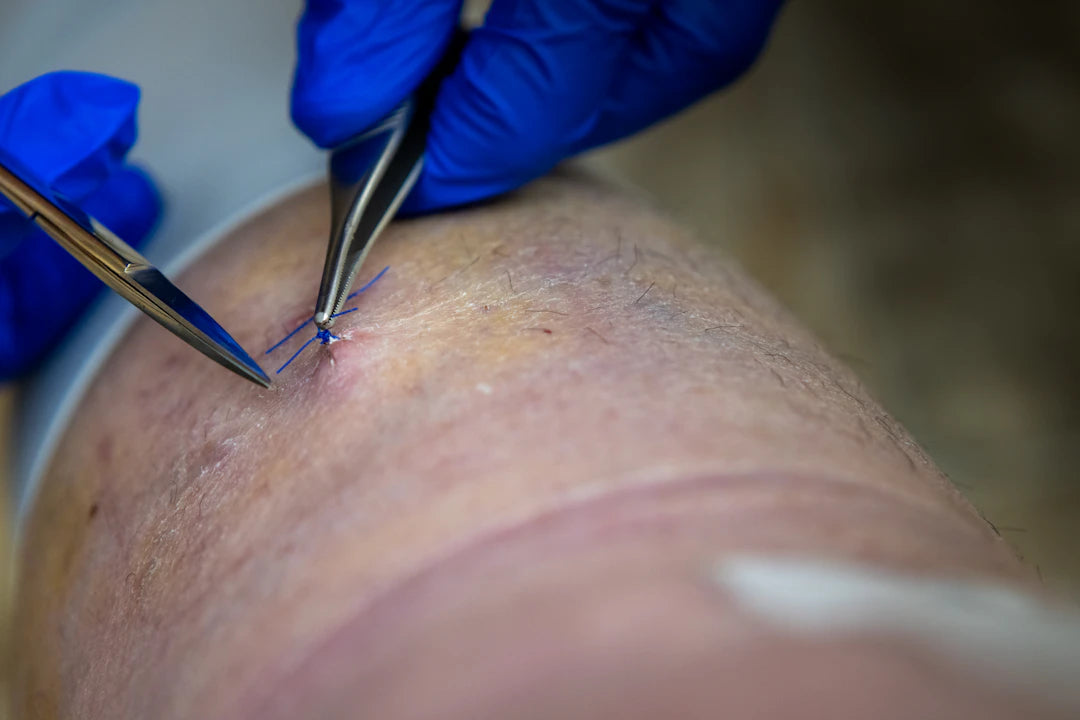 De Toekomst van Transdermale Supplementpleisters