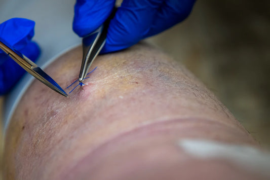 De Toekomst van Transdermale Supplementpleisters